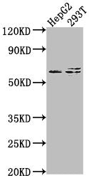 Western Blot Positive WB detected in: HepG2 whole cell lysate, 293T whole cell lysate All lanes: FZD7 antibody at 1:2000 Secondary Goat polyclonal to rabbit IgG at 1/50000 dilution Predicted band size: 64 kDa Observed band size: 64 kDa