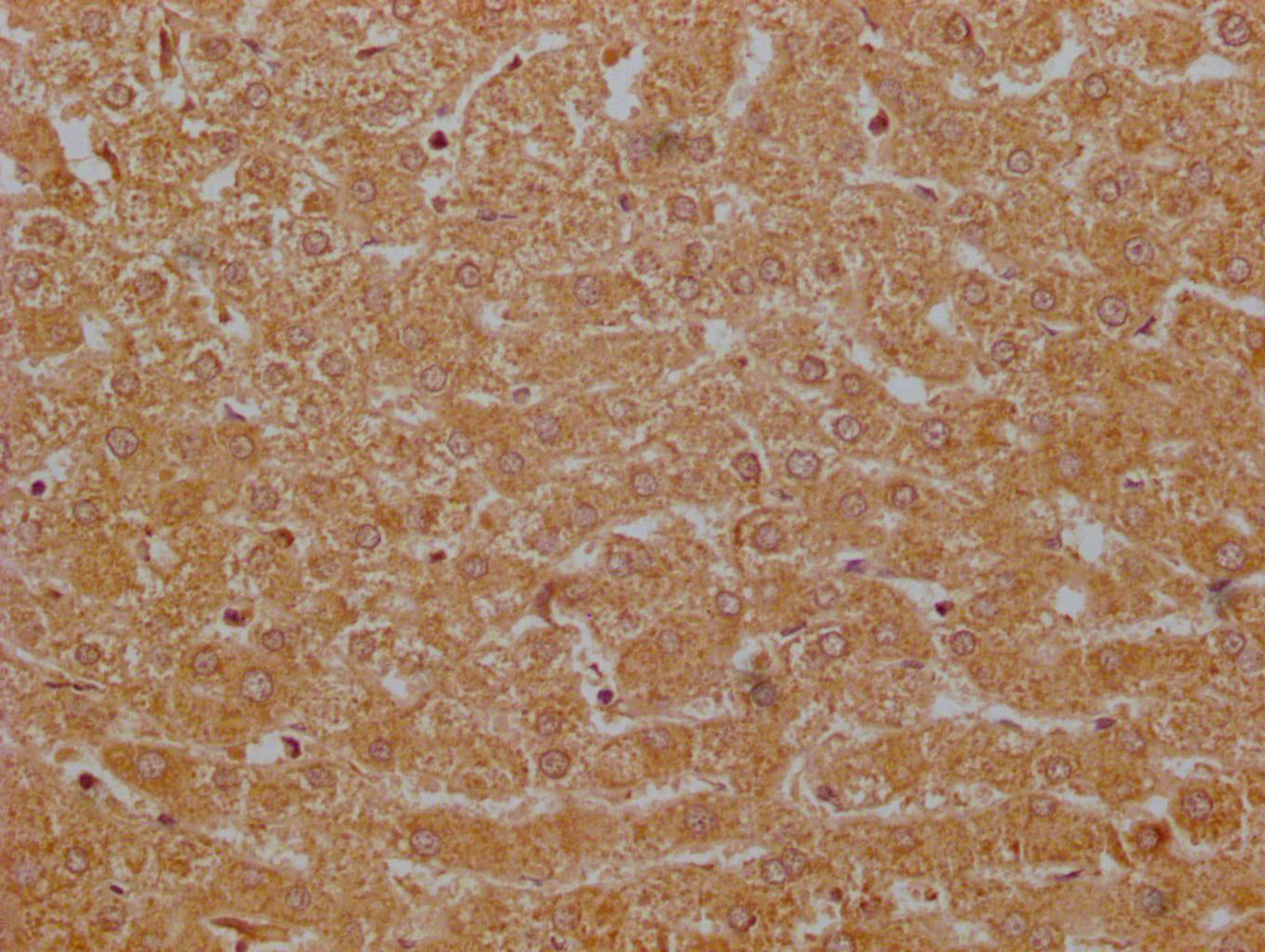 IHC image of CSB-PA009114EA01HU diluted at 1:200 and staining in paraffin-embedded human liver tissue performed on a Leica BondTM system. After dewaxing and hydration, antigen retrieval was mediated by high pressure in a citrate buffer (pH 6.0). S...