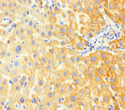 Immunohistochemistry of paraffin-embedded human liver tissue using CSB-PA009118LA01HU at dilution of 1:100