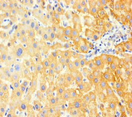 Immunohistochemistry of paraffin-embedded human liver tissue using CSB-PA009118LA01HU at dilution of 1:100