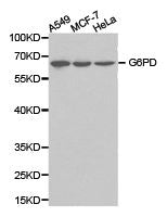 Western blot analysis of extracts of various cell lines, using G6PD antibody.