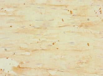 Immunohistochemistry of paraffin-embedded human skeletal muscle tissue using CSB-PA009143ESR1HU at dilution of 1:100