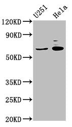 Western Blot Positive WB detected in: U251 whole cell lysate, Hela whole cell lysate All lanes: GABRA4 antibody at 7µg/ml Secondary Goat polyclonal to rabbit IgG at 1/50000 dilution Predicted band size: 62 kDa Observed band size: 62 kDa