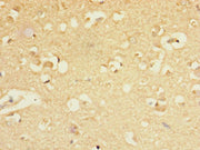 Immunohistochemistry of paraffin-embedded human brain tissue using CSB-PA009144ESR1HU at dilution of 1:100