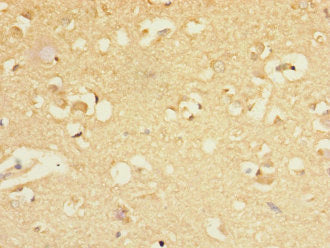 Immunohistochemistry of paraffin-embedded human brain tissue using CSB-PA009144ESR1HU at dilution of 1:100