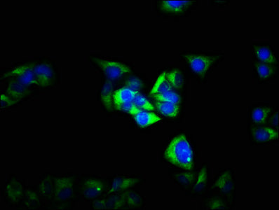 Immunofluorescence staining of Hela cells with CSB-PA009152LA01HU at 1:100, counter-stained with DAPI. The cells were fixed in 4% formaldehyde, permeabilized using 0.2% Triton X-100 and blocked in 10% normal Goat Serum. The cells were then incubat...