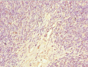 Immunohistochemistry of paraffin-embedded human thymus tissue using CSB-PA009156ESR2HU at dilution of 1:100