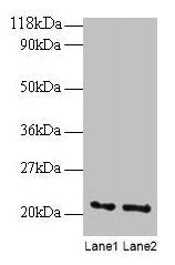 Western blot All lanes: ARF4 antibody at 2µg/ml Lane 1: EC109 whole cell lysate Lane 2: 293T whole cell lysate Secondary Goat polyclonal to rabbit IgG at 1/15000 dilution Predicted band size: 21 kDa Observed band size: 21 kDa