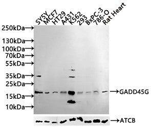 Western blot All lanes: GADD45G antibody IgG at 5.39ug/ml + Rat heart tissue Secondary Goat polyclonal to rabbit IgG at 1/10000 dilution Predicted band size: 17 kDa Observed band size: 17 kDa