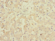 Immunohistochemistry of paraffin-embedded human liver tissue using CSB-PA009164DSR2HU at dilution of 1:100
