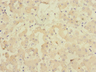 Immunohistochemistry of paraffin-embedded human liver tissue using CSB-PA009164DSR2HU at dilution of 1:100
