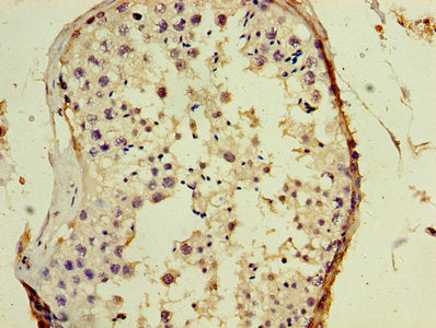 Immunohistochemistry of paraffin-embedded human testis tissue using CSB-PA009186EA01HUat dilution of 1:100