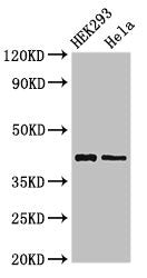 Western Blot Positive WB detected in: HEK293 whole cell lysate, Hela whole cell lysate All lanes: GALK1 antibody at 3ug/ml Secondary Goat polyclonal to rabbit IgG at 1/50000 dilution Predicted band size: 43, 46 kDa Observed band size: 43 kDa