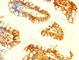 Immunohistochemistry of paraffin-embedded human small intestine tissue using CSB-PA009199LA01HU at dilution of 1:100