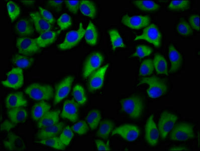 Immunofluorescence staining of A549 cells with CSB-PA009224LA01HU at 1:133, counter-stained with DAPI. The cells were fixed in 4% formaldehyde, permeabilized using 0.2% Triton X-100 and blocked in 10% normal Goat Serum. The cells were then incubat...