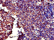 Immunohistochemistry of paraffin-embedded human tonsil tissue using CSB-PA009226LA01HU at dilution of 1:100