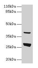 Western blot All lanes: Gamt antibody at 2µg/ml + Rat liver tissue Secondary Goat polyclonal to rabbit IgG at 1/10000 dilution Predicted band size: 27 kDa Observed band size: 27 kDa