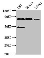 Western Blot Positive WB detected in: U87 whole cell lysate, Mouse brain tissue, Mouse liver tissue All lanes: GARS antibody at 3ug/ml Secondary Goat polyclonal to rabbit IgG at 1/50000 dilution Predicted band size: 84 kDa Observed band size: 84 kDa