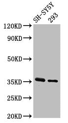 Western Blot Positive WB detected in: SH-SY5Y whole cell lysate, 293 whole cell lysate All lanes: GAS1 antibody at 3.2µg/ml Secondary Goat polyclonal to rabbit IgG at 1/50000 dilution Predicted band size: 36 kDa Observed band size: 36 kDa