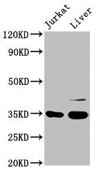 Western Blot Positive WB detected in: Jurkat whole cell lysate, Rat liver tissue All lanes: GAS2 antibody at 3.3µg/ml Secondary Goat polyclonal to rabbit IgG at 1/50000 dilution Predicted band size: 35, 16 kDa Observed band size: 35 kDa