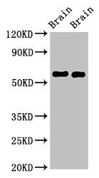 Western Blot Positive WB detected in: Mouse brain tissue, Rat brain tissue All lanes: GAS7 antibody at 2.5ug/ml Secondary Goat polyclonal to rabbit IgG at 1/50000 dilution Predicted band size: 55, 48, 40 kDa Observed band size: 55 kDa
