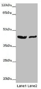 Western blot All lanes: GATA1 antibody at 7ug/ml Lane 1: MCF-7 whole cell lysate Lane 2: A549 whole cell lysate Secondary Goat polyclonal to rabbit IgG at 1/10000 dilution Predicted band size: 43, 36, 35 kDa Observed band size: 43 kDa