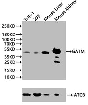 Western Blot Positive WB detected in: THP-1 whole cell lysate(20µg), 293 whole cell lysate(20µg), Mouse Liver tissue lysate(20µg), Mouse Kidney tissue lysate(20µg) All lanes: GATM antibody at 1:1000 Secondary Goat polyclonal to rabbit IgG at 1/500...