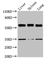 Western Blot Positive WB detected in: Mouse liver tissue, Mouse spleen tissue, Mouse lung tissue All lanes: Gba antibody at 3.5µg/ml Secondary Goat polyclonal to rabbit IgG at 1/50000 dilution Predicted band size: 58 kDa Observed band size: 58 kDa