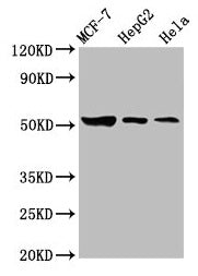 Western Blot Positive WB detected in: MCF-7 whole cell lysate, HepG2 whole cell lysate, Hela whole cell lysate All lanes: GBA antibody at 3.6µg/ml Secondary Goat polyclonal to rabbit IgG at 1/50000 dilution Predicted band size: 60, 58, 30, 51, 55...