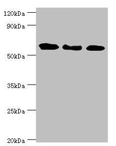 Western blot All lanes: Interferon-induced guanylate-binding protein 1 antibody at 4ug/ml Lane 1: MM231 whole cell lysate Lane 2: Hela whole cell lysate Lane 3: MGF-7 whole cell lysate Secondary Goat polyclonal to rabbit IgG at 1/10000 dilution Pr...