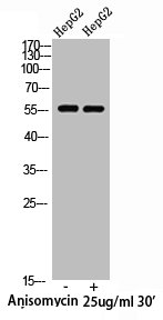 Western Blot analysis of HepG2 cells using Phospho-XIAP (S87) Polyclonal Antibody