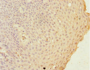 Immunohistochemistry of paraffin-embedded human tonsil tissue using CSB-PA009307DSR1HU at dilution of 1:100
