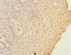 Immunohistochemistry of paraffin-embedded human tonsil tissue using CSB-PA009307DSR1HU at dilution of 1:100