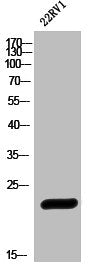 Western Blot analysis of 22RV1 cells using HSP27 Polyclonal Antibody