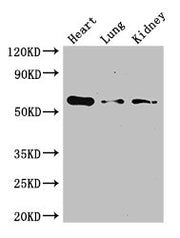 Western Blot Positive WB detected in: Mouse heart tissue, Mouse lung tissue, Mouse kidney tissue All lanes: Gcgr antibody at 3ug/ml Secondary Goat polyclonal to rabbit IgG at 1/50000 dilution Predicted band size: 55 kDa Observed band size: 55 kDa