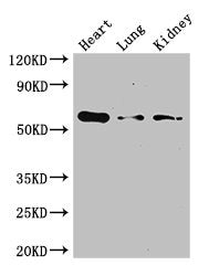 Western Blot Positive WB detected in: Mouse heart tissue, Mouse lung tissue, Mouse kidney tissue All lanes: Gcgr antibody at 3ug/ml Secondary Goat polyclonal to rabbit IgG at 1/50000 dilution Predicted band size: 55 kDa Observed band size: 55 kDa