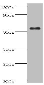 Western blot All lanes: Glucokinase antibody at 8ug/ml + HepG2 whole cell lysate Secondary Goat polyclonal to rabbit IgG at 1/10000 dilution Predicted band size: 52 kDa Observed band size: 52 kDa
