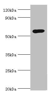 Western blot All lanes: Glucokinase antibody at 8ug/ml + Jurkat whole cell lysate Secondary Goat polyclonal to rabbit IgG at 1/10000 dilution Predicted band size: 52 kDa Observed band size: 52 kDa