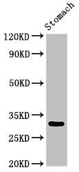 Western Blot Positive WB detected in: Rat stomach tissue All lanes: GCLM antibody at 3ug/ml Secondary Goat polyclonal to rabbit IgG at 1/50000 dilution Predicted band size: 31, 29 kDa Observed band size: 31 kDa