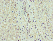 Immunohistochemistry of paraffin-embedded human liver tissue using CSB-PA009337ESR2HU at dilution of 1:100