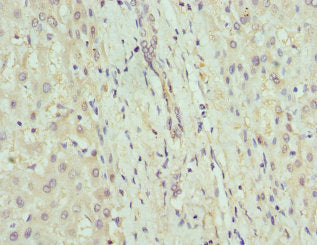 Immunohistochemistry of paraffin-embedded human liver tissue using CSB-PA009337ESR2HU at dilution of 1:100