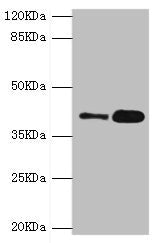 Western blot All lanes: GDAP1 antibody at 4.15µg/ml Lane 1: MCF-7 whole cell lysate Lane 2: Mouse brain tissue Secondary Goat polyclonal to rabbit IgG at 1/10000 dilution Predicted band size: 42, 34 kDa Observed band size: 42 kDa