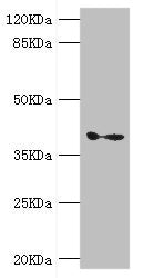 Western blot All lanes: GDAP1 antibody at 1.11ug/ml + Mouse brain tissue Secondary Goat polyclonal to rabbit IgG at 1/10000 dilution Predicted band size: 42, 34 kDa Observed band size: 42 kDa