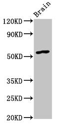 Western Blot Positive WB detected in: Rat brain tissue All lanes: GDF10 antibody at 4.5ug/ml Secondary Goat polyclonal to rabbit IgG at 1/50000 dilution Predicted band size: 54 kDa Observed band size: 54 kDa