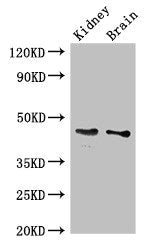 Western Blot Positive WB detected in: Mouse kidney tissue, Mouse brain tissue All lanes: GDF11 antibody at 3ug/ml Secondary Goat polyclonal to rabbit IgG at 1/50000 dilution Predicted band size: 46 kDa Observed band size: 46 kDa