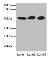 Western blot All lanes: GDI2 antibody at 2µg/ml Lane 1: Mouse brain tissue Lane 2: HepG2 whole cell lysate Lane 3: MCF-7 whole cell lysate Secondary Goat polyclonal to rabbit IgG at 1/10000 dilution Predicted band size: 51, 46 kDa Observed band si...