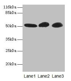 Western blot All lanes: GDI2 antibody at 2µg/ml Lane 1: Mouse brain tissue Lane 2: HepG2 whole cell lysate Lane 3: MCF-7 whole cell lysate Secondary Goat polyclonal to rabbit IgG at 1/10000 dilution Predicted band size: 51, 46 kDa Observed band si...
