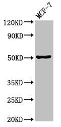 Western Blot Positive WB detected in: MCF-7 whole cell lysate All lanes: GFAP antibody at 3.4ug/ml Secondary Goat polyclonal to rabbit IgG at 1/50000 dilution Predicted band size: 50, 51 kDa Observed band size: 50 kDa
