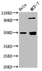 Western Blot Positive WB detected in: Hela whole cell lysate, MCF-7 whole cell lysate All lanes: GFAP antibody at 3.9µg/ml Secondary Goat polyclonal to rabbit IgG at 1/50000 dilution Predicted band size: 50, 51 kDa Observed band size: 50 kDa