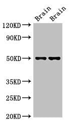 Western Blot Positive WB detected in: Mouse brain tissue, Rat brain tissue All lanes: Gfap antibody at 2.7µg/ml Secondary Goat polyclonal to rabbit IgG at 1/50000 dilution Predicted band size: 50, 49 kDa Observed band size: 50 kDa
